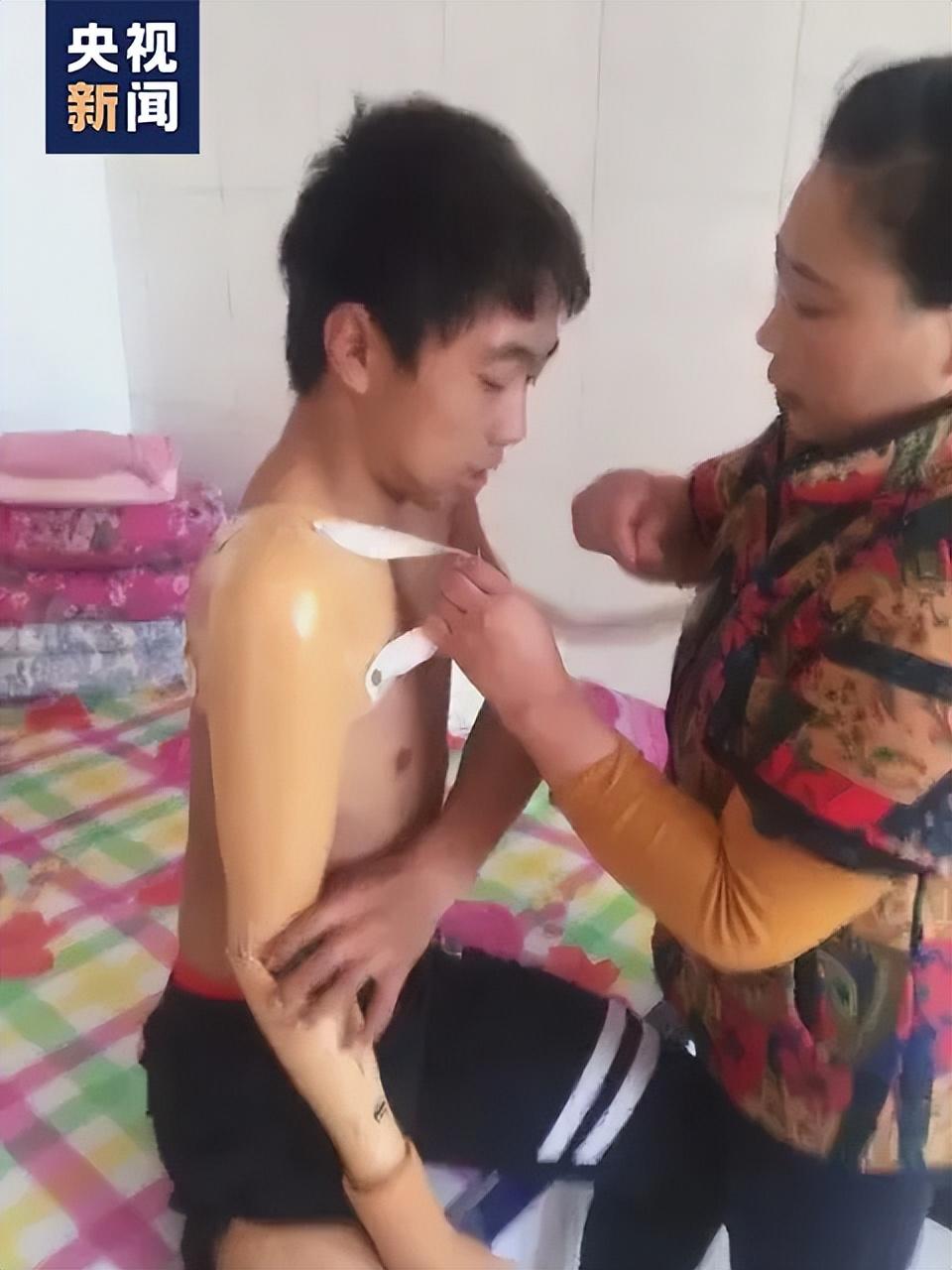 江苏省残疾人自行车运动员_2021年残疾人自行车全运会_辽宁省残疾人自行车运动员